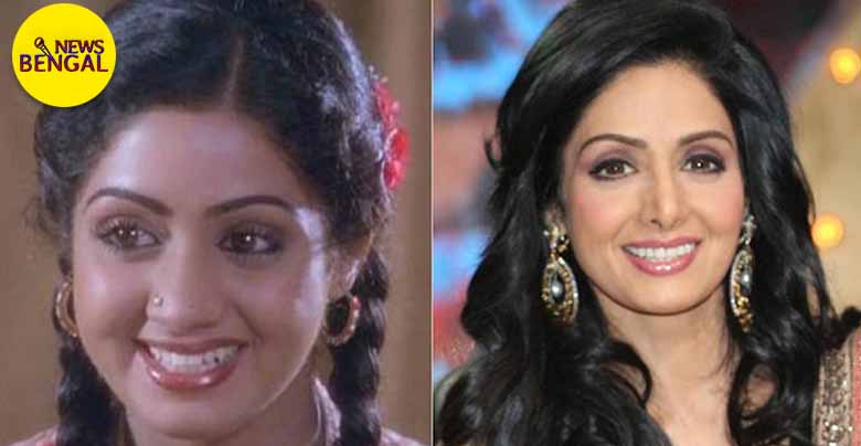 All the Bollywood actresses who have undergone the horrific consequences of plastic surgery in order to be beautiful