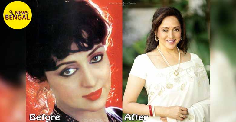 All the Bollywood actresses who have undergone the horrific consequences of plastic surgery in order to be beautiful