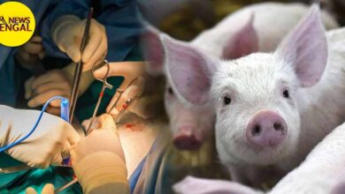 Pig's kidney in human body! Massive success in the medical field